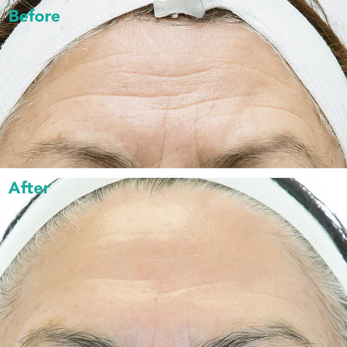Anti-Aging Retinol Serum PDRN