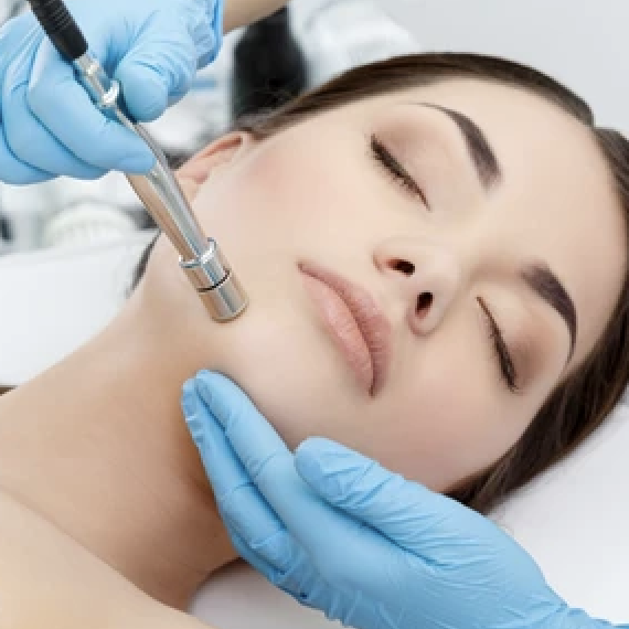 LIMPIEZA PROFUNDA CON MICRODERMABRASION