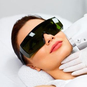 DEPILACIÓN LASER MENTÓN